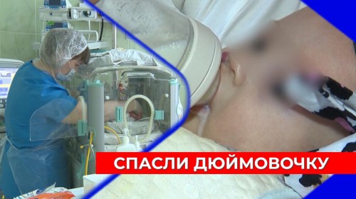 Новорождённую весом всего 490 граммов спасли и выходили нижегородские врачи